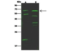 Invitrogen IL18RAP Polyclonal Antibody 100 &mu;L; Unconjugated:Antibodies,