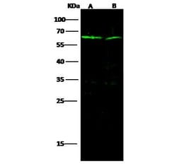Invitrogen IL-1RAcP Polyclonal Antibody 100 &mu;L; Unconjugated:Antibodies,