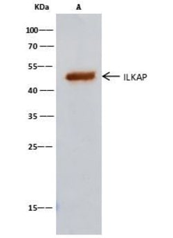 Invitrogen ILKAP Polyclonal Antibody 100 &mu;L; Unconjugated:Antibodies,