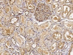 Invitrogen CD51 Polyclonal Antibody 100 &mu;L; Unconjugated:Antibodies,