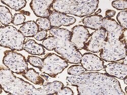 Invitrogen CD51 Polyclonal Antibody 100 &mu;L; Unconjugated:Antibodies,