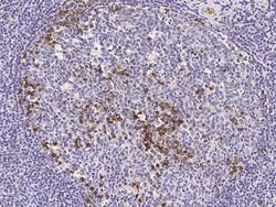 Invitrogen CD51 Polyclonal Antibody 100 &mu;L; Unconjugated:Antibodies,
