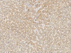 Invitrogen PHF17 Polyclonal Antibody 100 &mu;L; Unconjugated:Antibodies,