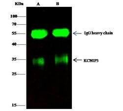 Invitrogen KChIP3 Polyclonal Antibody 100 &mu;L; Unconjugated:Antibodies,