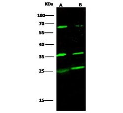 Invitrogen SCF Polyclonal Antibody 100 &mu;L; Unconjugated:Antibodies,