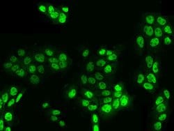 Invitrogen KLF17 Polyclonal Antibody 100 &mu;L; Unconjugated:Antibodies,