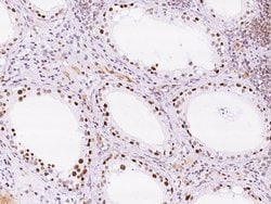 Invitrogen KLF17 Polyclonal Antibody 100 &mu;L; Unconjugated:Antibodies,