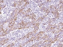 Invitrogen Cytokeratin 6C Polyclonal Antibody 100 &mu;L; Unconjugated:Antibodies,