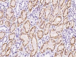 Invitrogen RAP Polyclonal Antibody 100 &mu;L; Unconjugated:Antibodies,