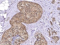Invitrogen LSM1 Polyclonal Antibody 100 &mu;L; Unconjugated:Antibodies,