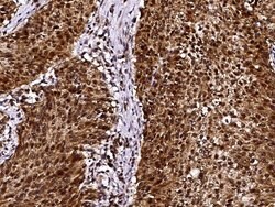 Invitrogen LSM1 Polyclonal Antibody 100 &mu;L; Unconjugated:Antibodies,