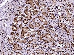 Invitrogen LSM1 Polyclonal Antibody 100 &mu;L; Unconjugated:Antibodies,