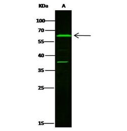 Invitrogen LTA4H Polyclonal Antibody 100 &mu;L; Unconjugated:Antibodies,