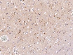 Invitrogen LC3A Polyclonal Antibody 100 μL; Unconjugated:Antibodies,