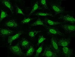 Invitrogen MAP2K4 Polyclonal Antibody 100 &mu;L; Unconjugated:Antibodies,