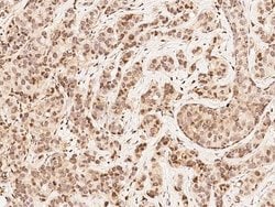 Invitrogen MAP2K4 Polyclonal Antibody 100 &mu;L; Unconjugated:Antibodies,