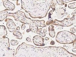 Invitrogen MAPKAPK3 Polyclonal Antibody 100 &mu;L; Unconjugated:Antibodies,