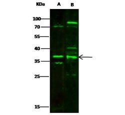 Invitrogen MBD3 Polyclonal Antibody 100 &mu;L; Unconjugated:Antibodies,