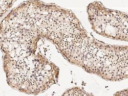 Invitrogen MBD3L1 Polyclonal Antibody 100 &mu;L; Unconjugated:Antibodies,