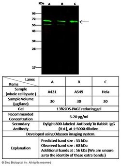 MDMX Polyclonal Antibody:Antibodies, Polyclonal