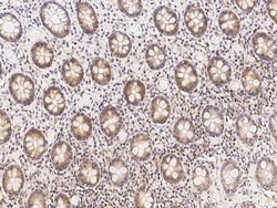 Invitrogen METAP2 Polyclonal Antibody 100 &mu;L; Unconjugated:Antibodies,