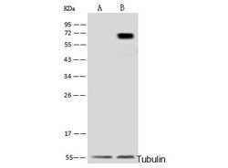Invitrogen METAP2 Polyclonal Antibody 100 &mu;L; Unconjugated:Antibodies,