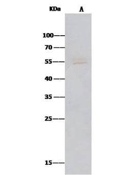 Invitrogen MICA Polyclonal Antibody 100 &mu;L; Unconjugated:Antibodies,