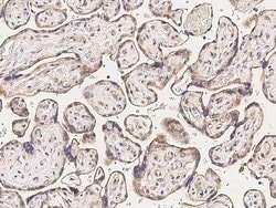 Invitrogen MMP26 Polyclonal Antibody 100 &mu;L; Unconjugated:Antibodies,