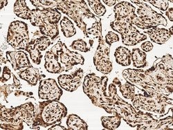 Invitrogen MRTO4 Polyclonal Antibody 100 &mu;L; Unconjugated:Antibodies,