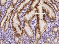Invitrogen RON Polyclonal Antibody 100 &mu;L; Unconjugated:Antibodies,