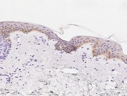 Invitrogen RON Polyclonal Antibody 100 &mu;L; Unconjugated:Antibodies,