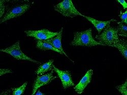 Invitrogen MVP Polyclonal Antibody 100 &mu;L; Unconjugated:Antibodies,