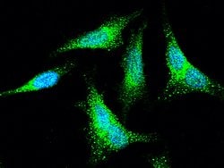 Invitrogen SNAP alpha/beta Polyclonal Antibody 100 &mu;L; Unconjugated:Antibodies,