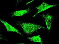 Invitrogen NCAPH Polyclonal Antibody 100 &mu;L; Unconjugated:Antibodies,