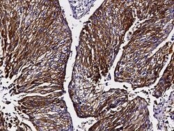 Invitrogen NDRG1 Polyclonal Antibody 100 &mu;L | Buy Online | Invitrogen&trade; | Fisher Scientific