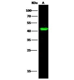 Invitrogen NDRG1 Polyclonal Antibody 100 &mu;L | Buy Online | Invitrogen&trade; | Fisher Scientific
