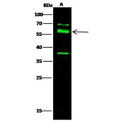 Invitrogen Nectin 3 Polyclonal Antibody 100 &mu;L; Unconjugated:Antibodies,