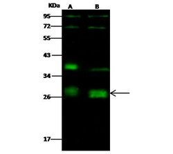Invitrogen Neurogenin 2 Polyclonal Antibody 100 &mu;L | Buy Online | Invitrogen&trade; | Fisher Scientific