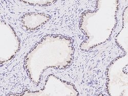 Invitrogen Nkx3.1 Polyclonal Antibody 100 &mu;L; Unconjugated:Antibodies,