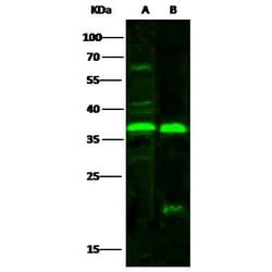 Invitrogen NT5C3A Polyclonal Antibody 100 &mu;L; Unconjugated:Antibodies,