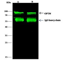 Invitrogen Optineurin Polyclonal Antibody 100 &mu;L; Unconjugated:Antibodies,