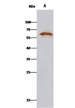 Invitrogen PDI Polyclonal Antibody 100 &mu;L; Unconjugated:Antibodies,