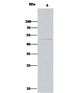 Invitrogen PARVA Polyclonal Antibody 100 &mu;L; Unconjugated:Antibodies,