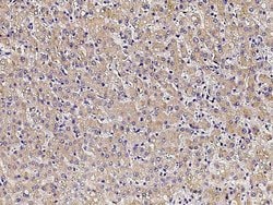 PCSK9 Polyclonal Antibody, Invitrogen 100 &mu;L; Unconjugated:Antibodies,