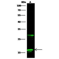 Invitrogen PFDN2 Polyclonal Antibody 100 &mu;L; Unconjugated:Antibodies,