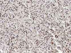 Invitrogen PHYH Polyclonal Antibody 100 &mu;L | Buy Online | Invitrogen&trade; | Fisher Scientific