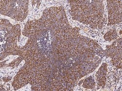 Invitrogen LPPR4 Polyclonal Antibody 100 &mu;L; Unconjugated:Antibodies,