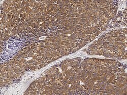 Invitrogen PMM2 Polyclonal Antibody 100 &mu;L; Unconjugated:Antibodies,