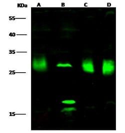 Invitrogen PMM2 Polyclonal Antibody 100 &mu;L; Unconjugated:Antibodies,