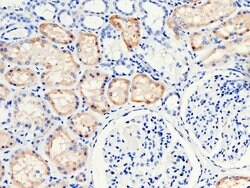 Invitrogen RBP4 Polyclonal Antibody 100 &mu;L; Unconjugated:Antibodies,